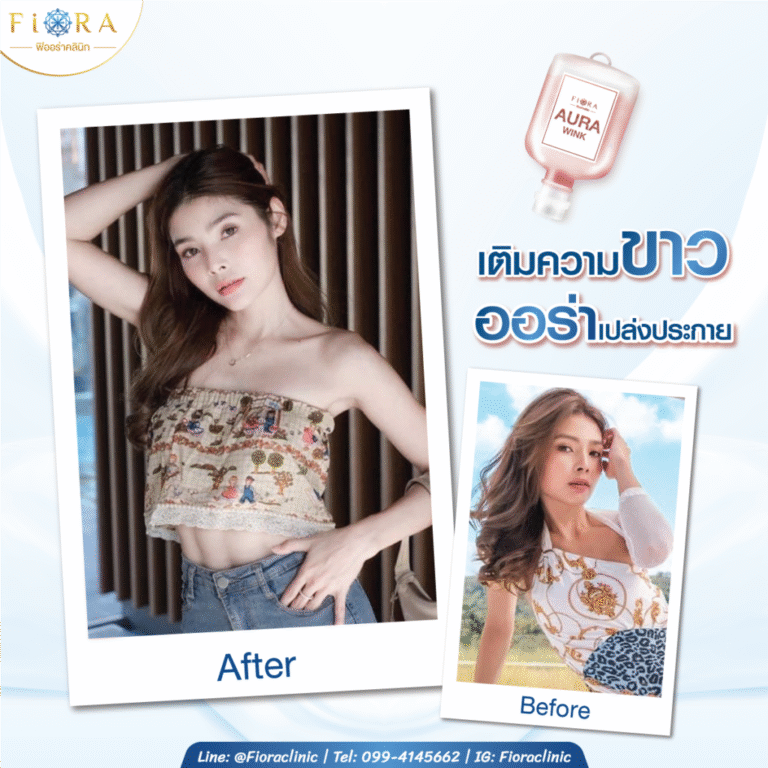 4 ปัญหาผิว